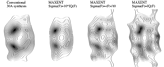 Sensitivity to standard deviations