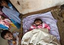An Indian girl, born with four eyes, two noses 
and two mouths is watched by another child as she rests on a cot at the 
Saini Village of Noida, some 55 kms from New Delhi, on April 5. The 
parents of the girl say that the toddler is doing well and that they 
have no plans for a surgery.(AFP/Manan Vatsyayana)